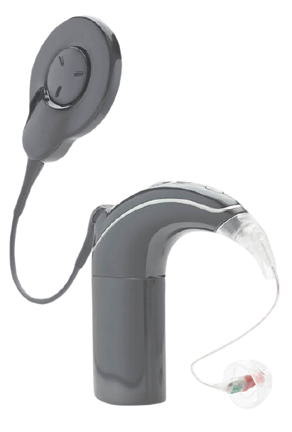 Cochlear Implant